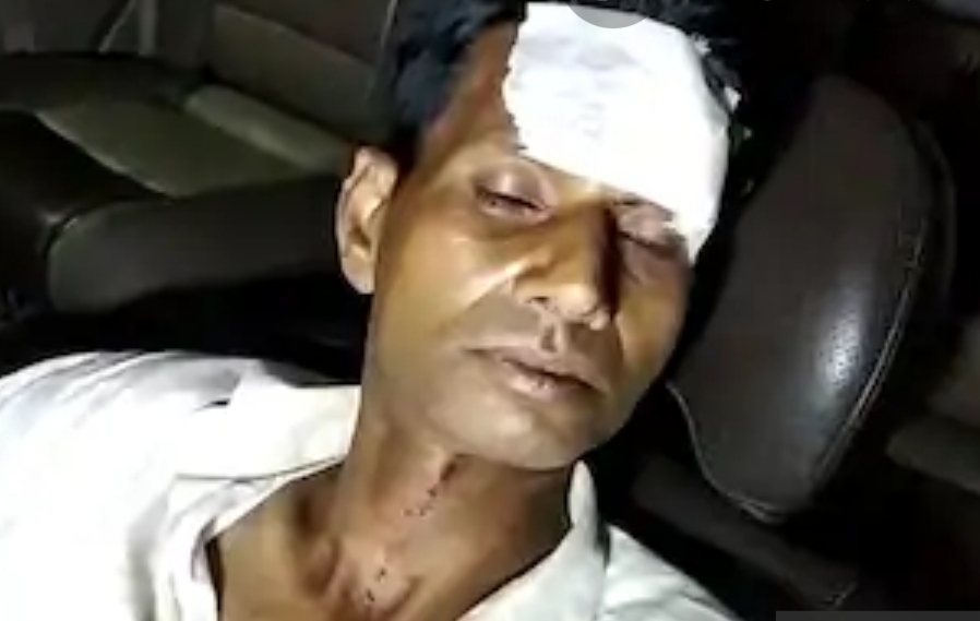 गाजियाबाद – बलिया के बाद अब मेरठ में दबंगों ने किया पत्रकार पर हमला,गंभीर घायल